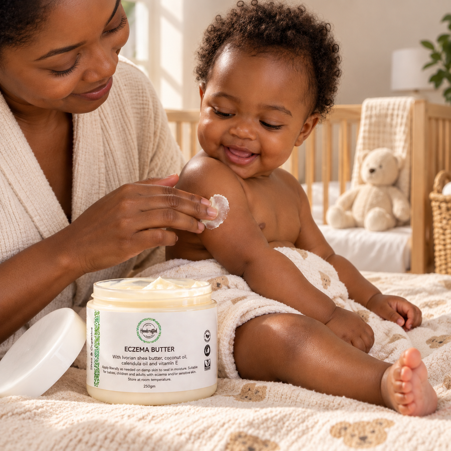 Eczema